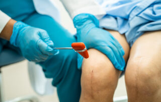 ACL surgeon